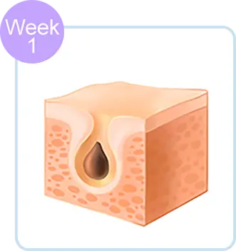Reduce sebum and blackheads and relieve pores