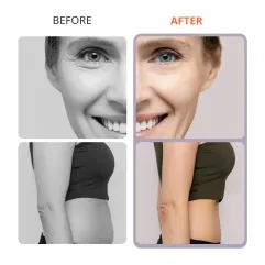 ARISTORM S Shape Cavitation Machine Body Slimming Skin Firming Facial Lifting for Home Use