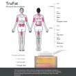 Multi-Functional RF Fat Reduction Body Sculpting Face Lifting Machine