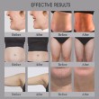 Multi-Functional RF Fat Reduction Body Sculpting Face Lifting Machine