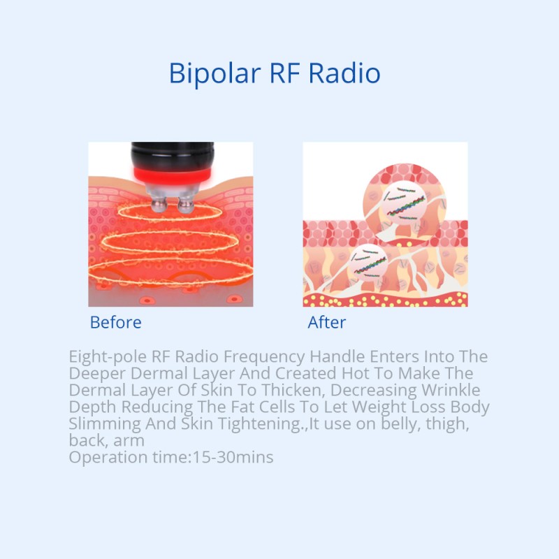 fat freezing device front