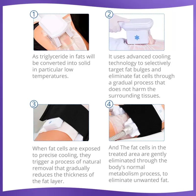 professional cellulite treatment machine principle