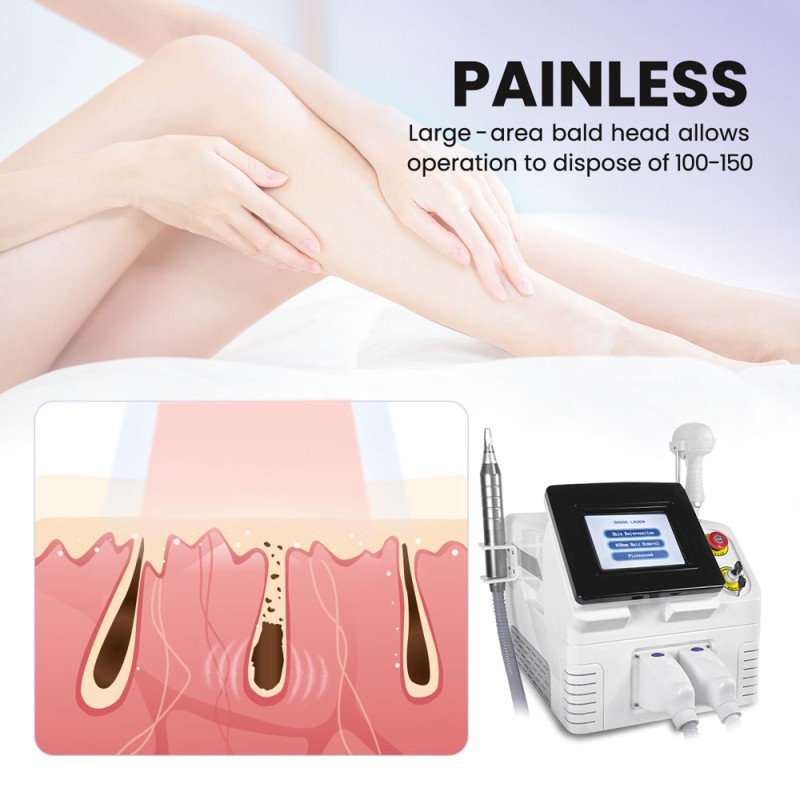 Multifunction Laser Machine Nd-yag Tattoo Removal Beauty Equipment Hair Removal freatures