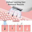 laser hair removal shr