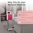laser hair removal shr