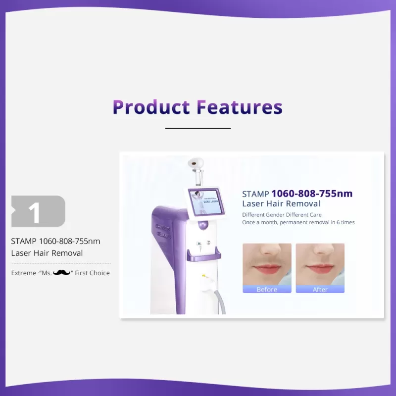 diode laser hair removal machine for sale