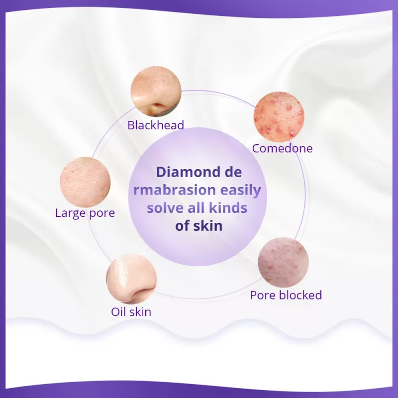 best at home microdermabrasion advantages