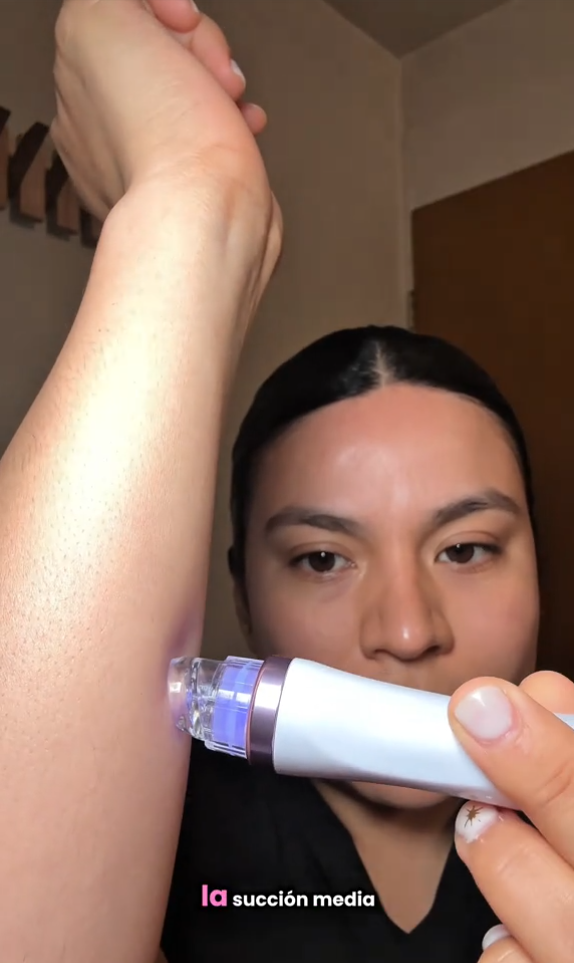 Part 2 Hydrodermoabrasion 6 in 1, If you are looking for a machine that does its job well, has good suction, and actually exfoliates and removes impurities, you are in the right video AF1323-MX 