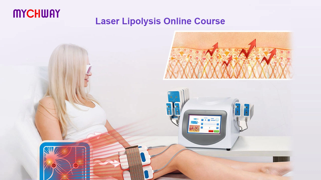 Laser Lipolysis Online Course