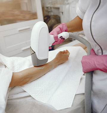 What Are Your Options to Remove Hair Permanently?