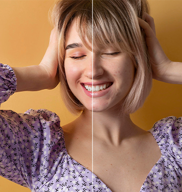 Microdermabrasion before and after -- Everything You Need to Know