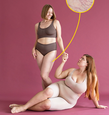 Loose Skin Vs. Fat : What's The Difference?