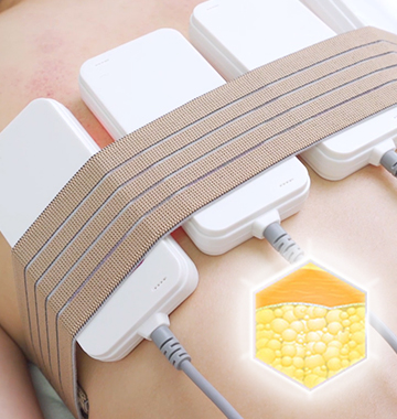 Which laser lipo machine is best?