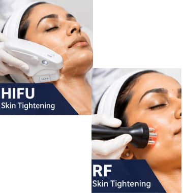HIFU vs RF Skin Tightening: Which Is Better? Full Comparison 2026
